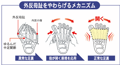 外反母趾をやわらげるメカニズム